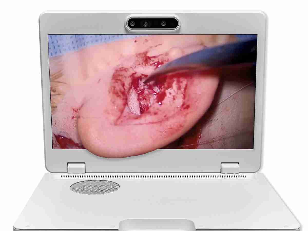 达擎之＂Heads-up 3D显微手术显示系统＂，，，整合4K裸眼3D显示及眼球追踪系统，，，具备快速追踪人眼移动位置功能，，，，减轻医师长时间维持固定姿势的负担，，，让医师能有更宽广清晰的3D立体视野及更舒适的姿势来执行手术。。